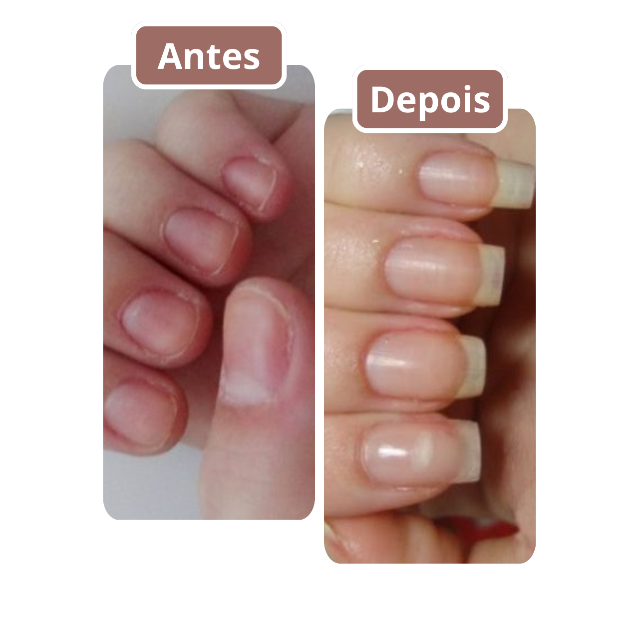 ⭐⭐⭐⭐⭐Aleyna SousaSempre tive unhas fracas e que quebravam facilmente. Depois de começar a usar Revita Glow, notei uma diferença incrível. Minhas unhas estão muito mais fortes e saudáveis.